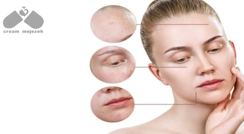 انواع لک های پوستی و درمان