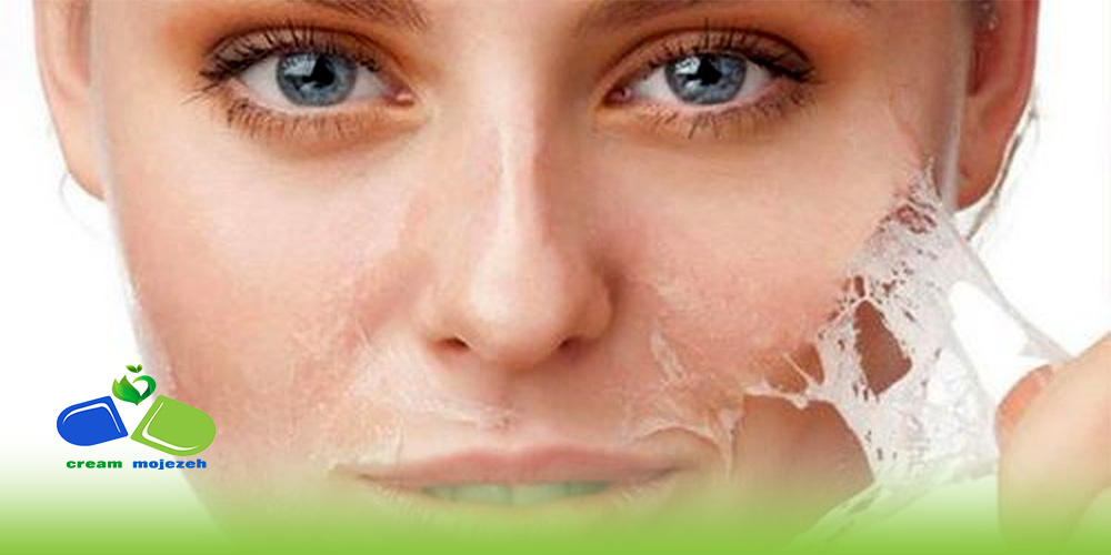 درمان تیرگی پوست با محصولات گیاهی و آسیب های پوستی