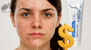 کرم آداپالن